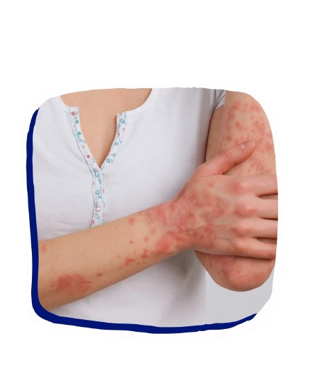 allery_and_immunology_billing_services